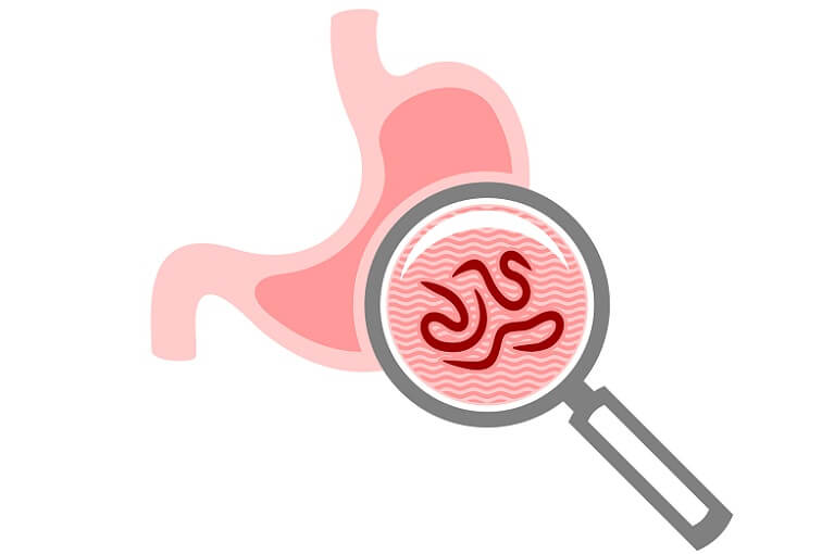 胃アニサキスとは