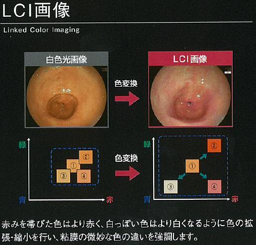 次世代最新鋭の内視鏡システム使用